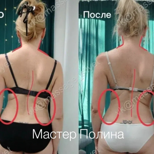 posture_correction